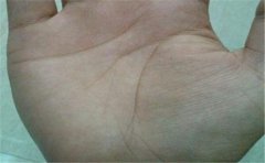 <b>手相解析:棺材纹手相怎么办?如何化解</b>