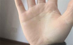 生命线看生命力强弱，身体状况跟其特征关系大