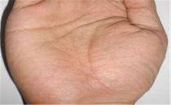 指甲除了可以看小月牙之外，手相指甲形状也重