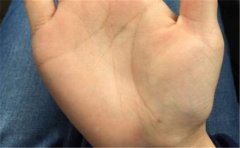 <b>婚姻线图解告诉你，哪些婚姻线好哪些婚姻线不</b>