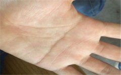 分析手相手背青筋暴露好不好，客观且全面