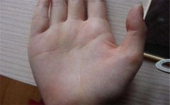 手相的命运线怎么看