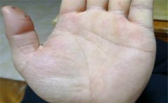 看手相掌纹断是不是一种好兆头呢