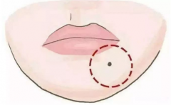 對照女面相痣圖解 瞭解自己的運勢