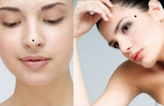 最全女面相痣圖解 點痣的趕緊打開看看