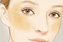 左耳有痣代表什麼 男女耳朵上不同位置的痣有什麼含義