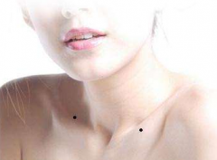 痣相風水學，通過不同的痣，瞭解個人不同的運勢