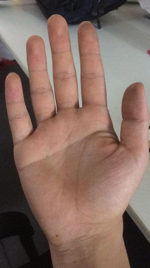 断掌为什么不能告诉别人 算命先生为什么不给断掌的人算命